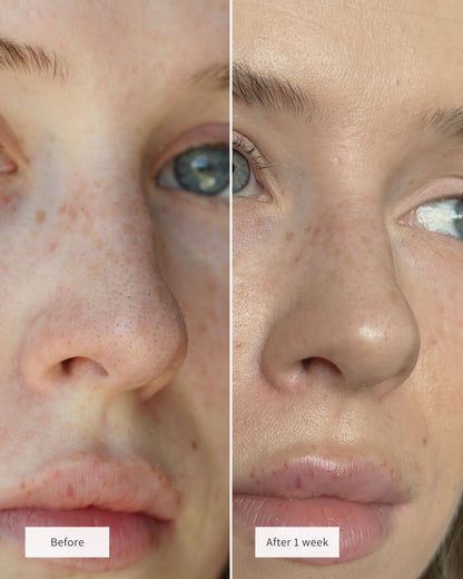 Hydrocolloid Pore Patch Nose Patch Cleans Pores