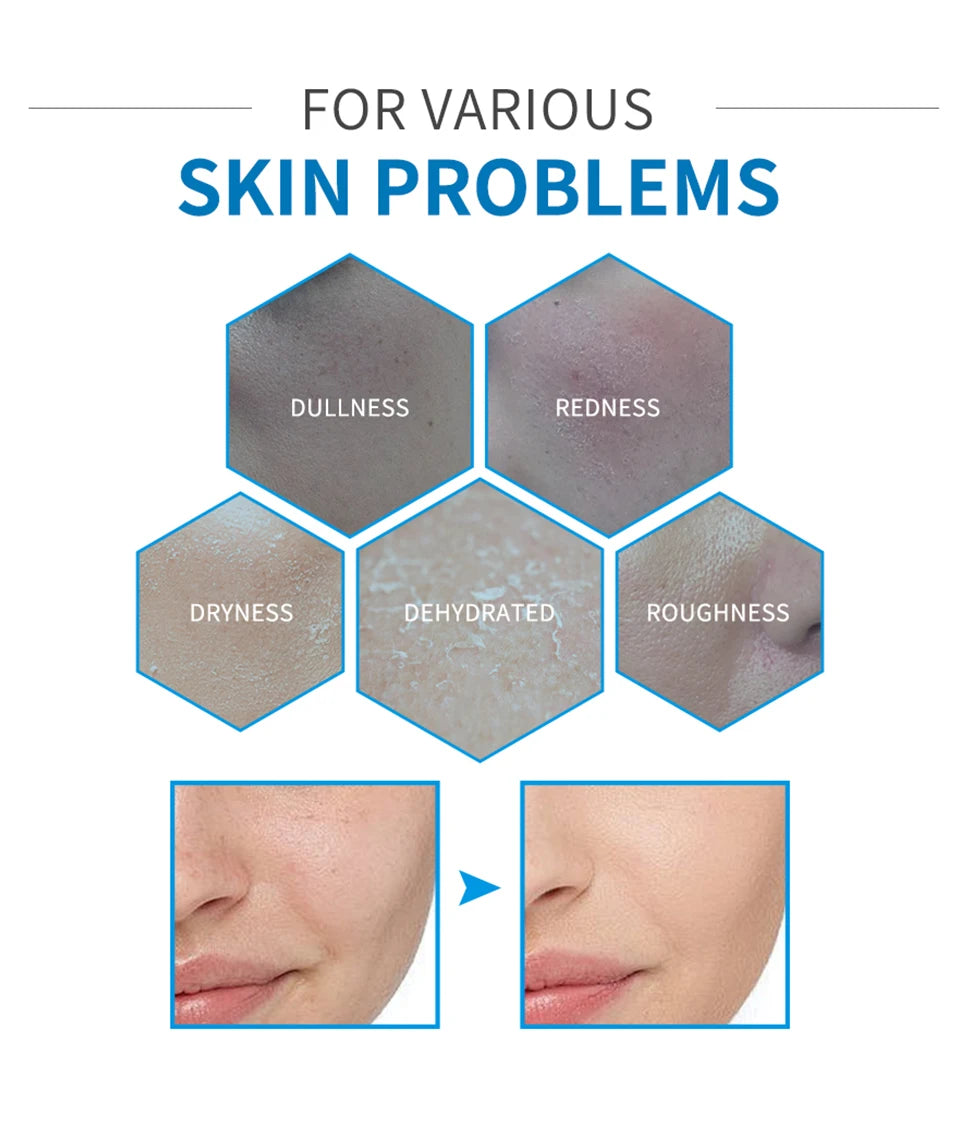 5-piece Set Hyaluronic Acid Skincare Set Essence Cleanser Eye Cream Face Cream Hydrating Moisturizing Repair Skin Care Product