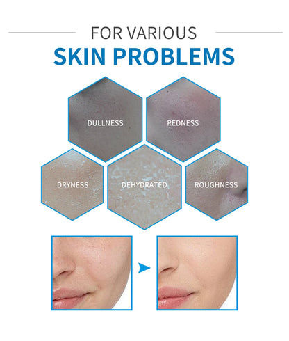 5-piece Set Hyaluronic Acid Skincare Set Essence Cleanser Eye Cream Face Cream Hydrating Moisturizing Repair Skin Care Product
