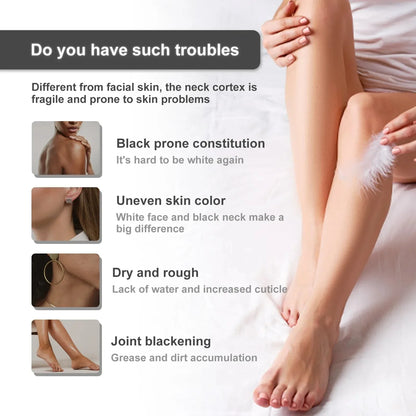 Body Whitening Bleach Cream Brighten Face and Body Removal Private Parts Underarm Elbow Knees Joint Dark Spot Melanin Cream 30ml